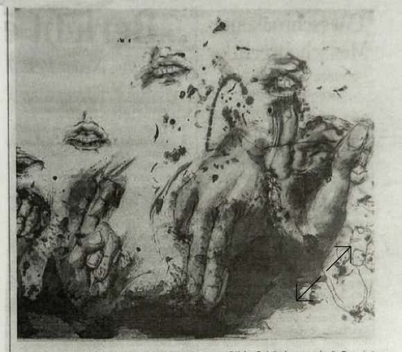 hartmut renner, konvention über rechte von menschen mit behinderung, 2011